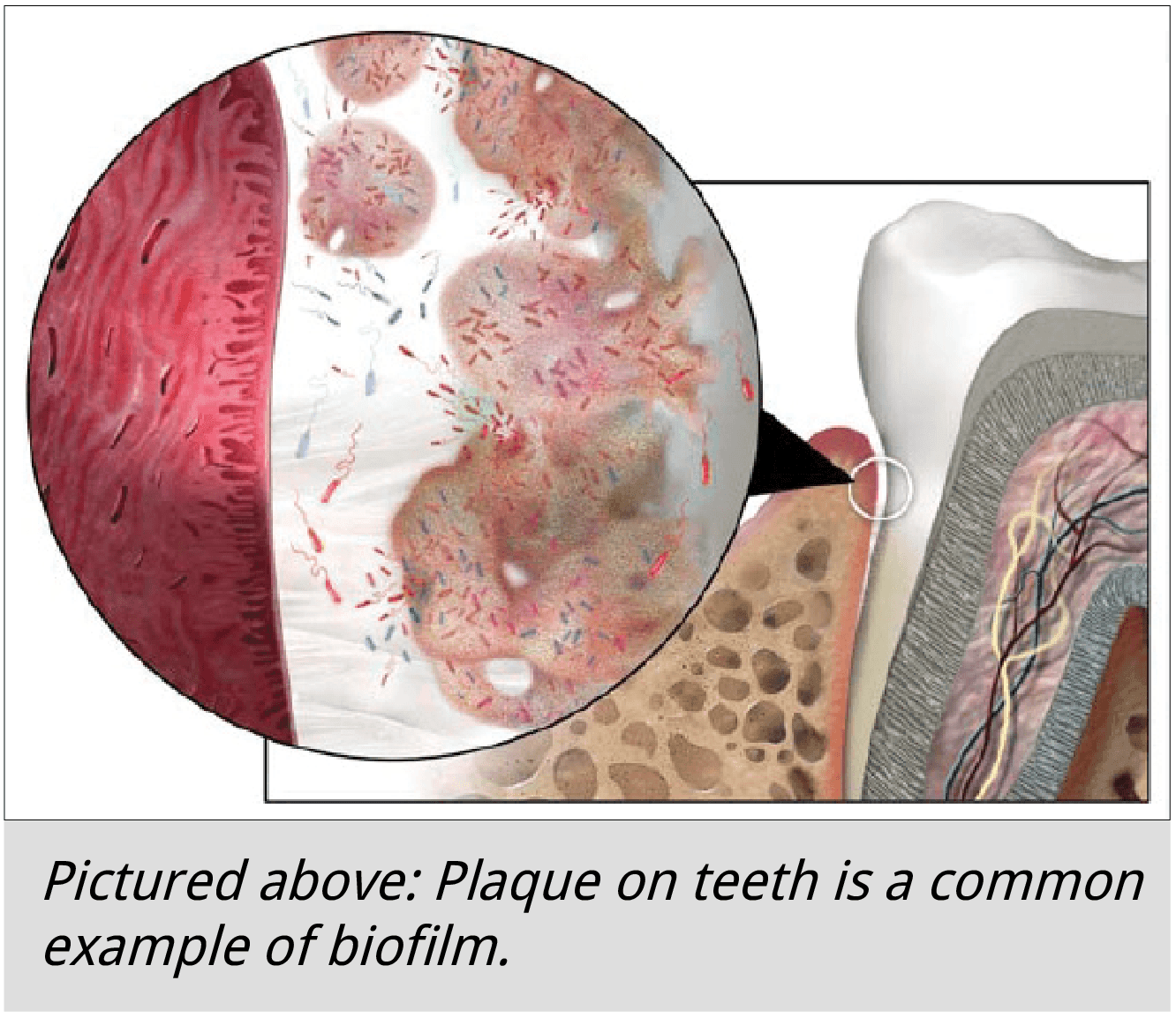 tooth plaque is an example of biofilm