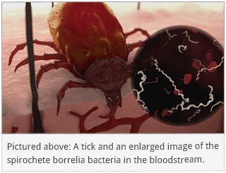 A tick and an enlarged image of spirochete bacteria in the bloodstream